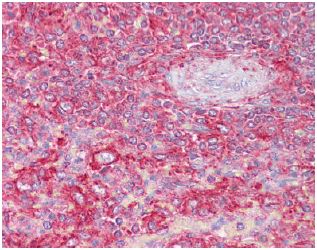 Immunohistochemistry (Formalin/PFA-fixed paraffin-embedded sections) - Anti-Clathrin light chain antibody (AB129326), expandable thumbnail