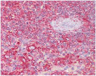 Immunohistochemistry (Formalin/PFA-fixed paraffin-embedded sections) - Anti-Clathrin light chain antibody (AB129326)