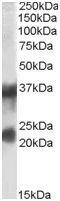 Western blot - Anti-Clathrin light chain antibody (AB129326), expandable thumbnail