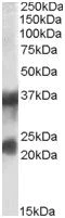 Western blot - Anti-Clathrin light chain antibody (AB129326)