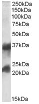 Western blot - Anti-Clathrin light chain antibody (AB77542)