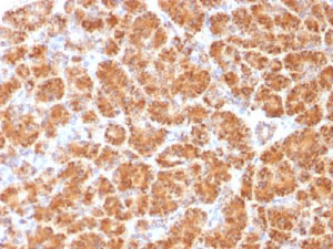 Immunohistochemistry (Formalin/PFA-fixed paraffin-embedded sections) - Anti-Clathrin light chain antibody [CLC/1421] - BSA and Azide free (AB269758), expandable thumbnail