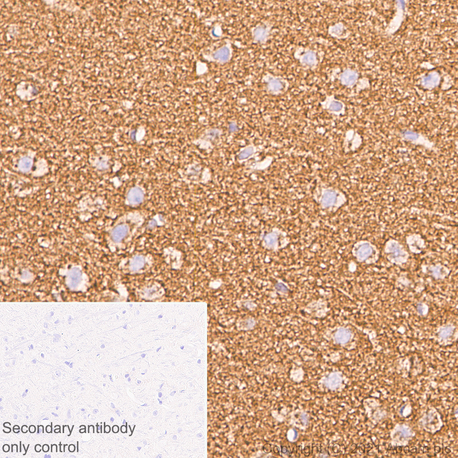 Immunohistochemistry (Formalin/PFA-fixed paraffin-embedded sections) - Anti-Clathrin light chain antibody [EPR24231-72] (ab271185), expandable thumbnail