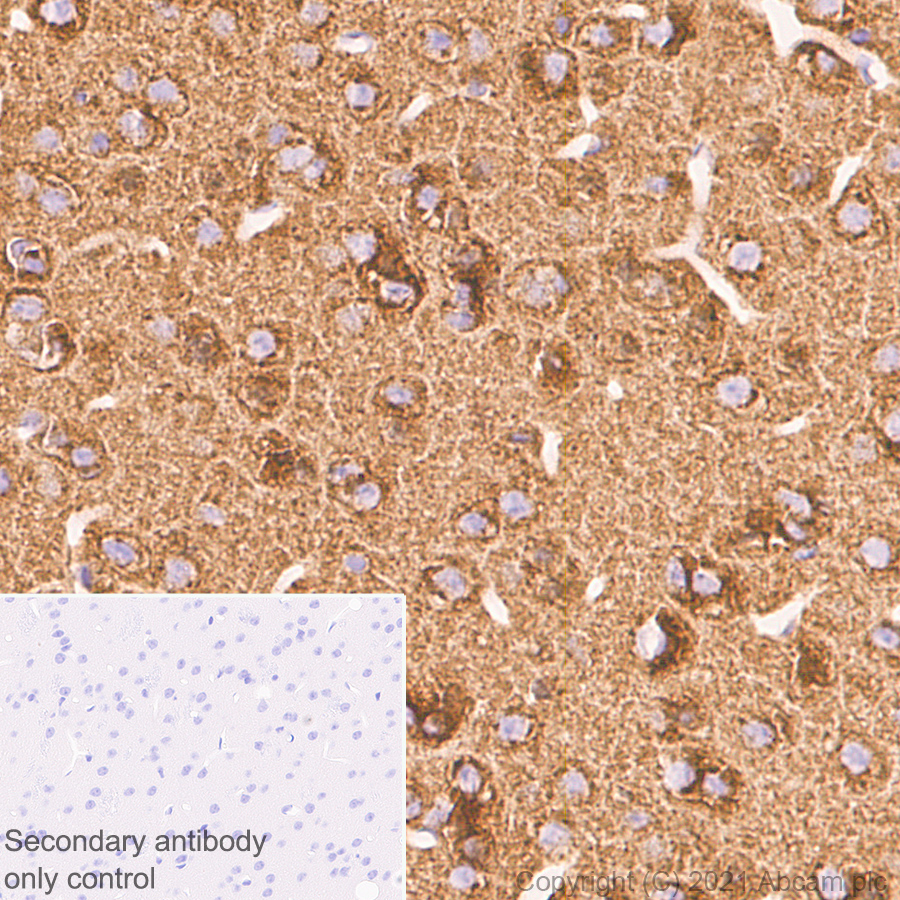 Immunohistochemistry (Formalin/PFA-fixed paraffin-embedded sections) - Anti-Clathrin light chain antibody [EPR24231-72] (ab271185), expandable thumbnail
