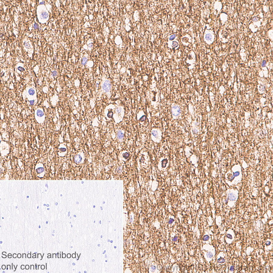 Immunohistochemistry (Formalin/PFA-fixed paraffin-embedded sections) - Anti-Clathrin light chain antibody [EPR24231-72] (AB271185), expandable thumbnail