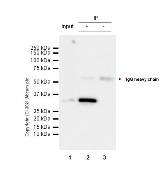 Immunoprecipitation - Anti-Clathrin light chain antibody [EPR24231-72] (AB271185), expandable thumbnail