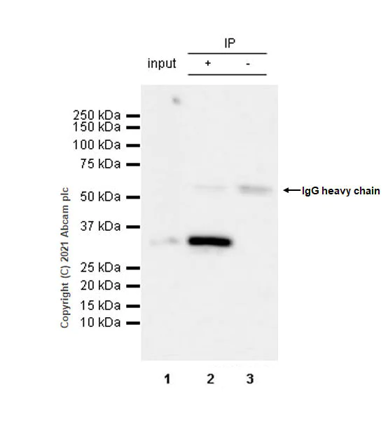 Immunoprecipitation - Anti-Clathrin light chain antibody [EPR24231-72] (AB271185)