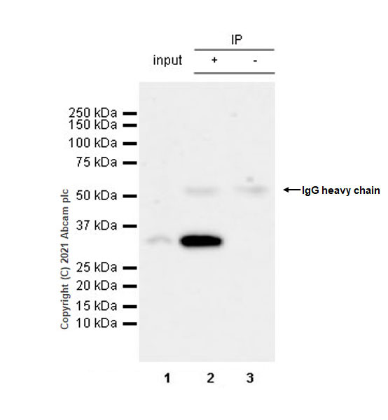 Immunoprecipitation - Anti-Clathrin light chain antibody [EPR24231-72] (ab271185), expandable thumbnail