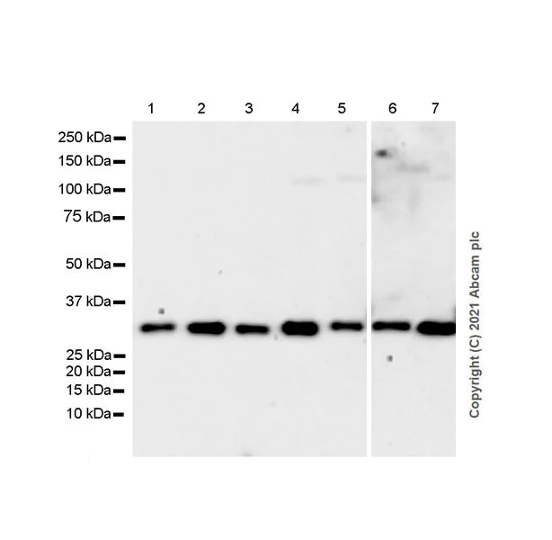 Western blot - Anti-Clathrin light chain antibody [EPR24231-72] (AB271185)