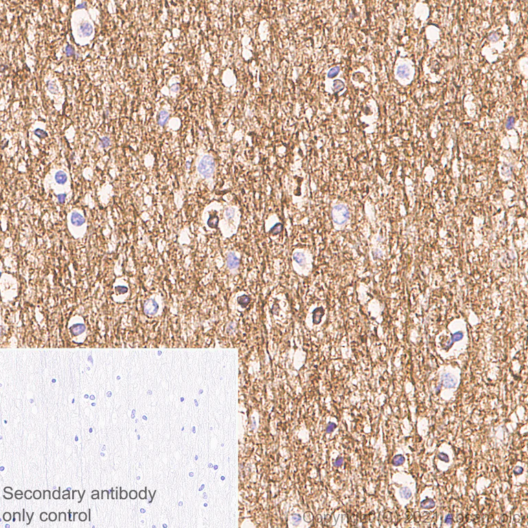 Immunohistochemistry (Formalin/PFA-fixed paraffin-embedded sections) - Anti-Clathrin light chain antibody [EPR24231-72] - BSA and Azide free (AB282013)
