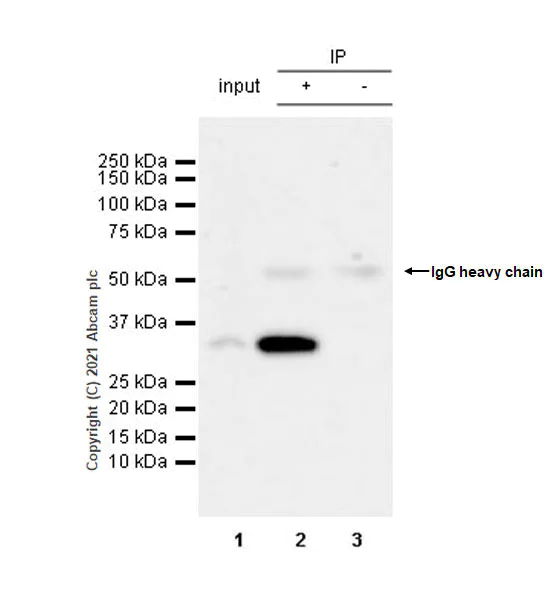 Immunoprecipitation - Anti-Clathrin light chain antibody [EPR24231-72] - BSA and Azide free (AB282013)