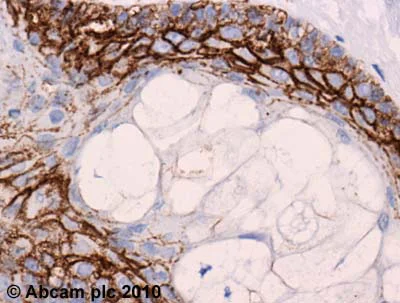 Immunohistochemistry (Formalin/PFA-fixed paraffin-embedded sections) - Anti-Claudin 1 antibody (AB15098)