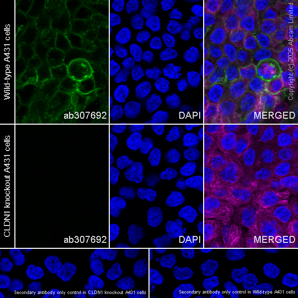 Immunocytochemistry/ Immunofluorescence - Anti-Claudin 1 antibody [EPR25359-48] (AB307692)