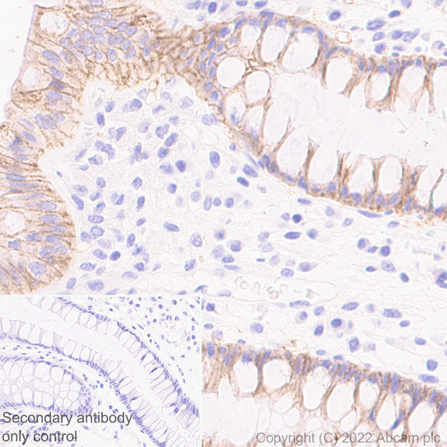 Immunohistochemistry (Formalin/PFA-fixed paraffin-embedded sections) - Anti-Claudin 1 antibody [EPR25359-48] (ab307692), expandable thumbnail