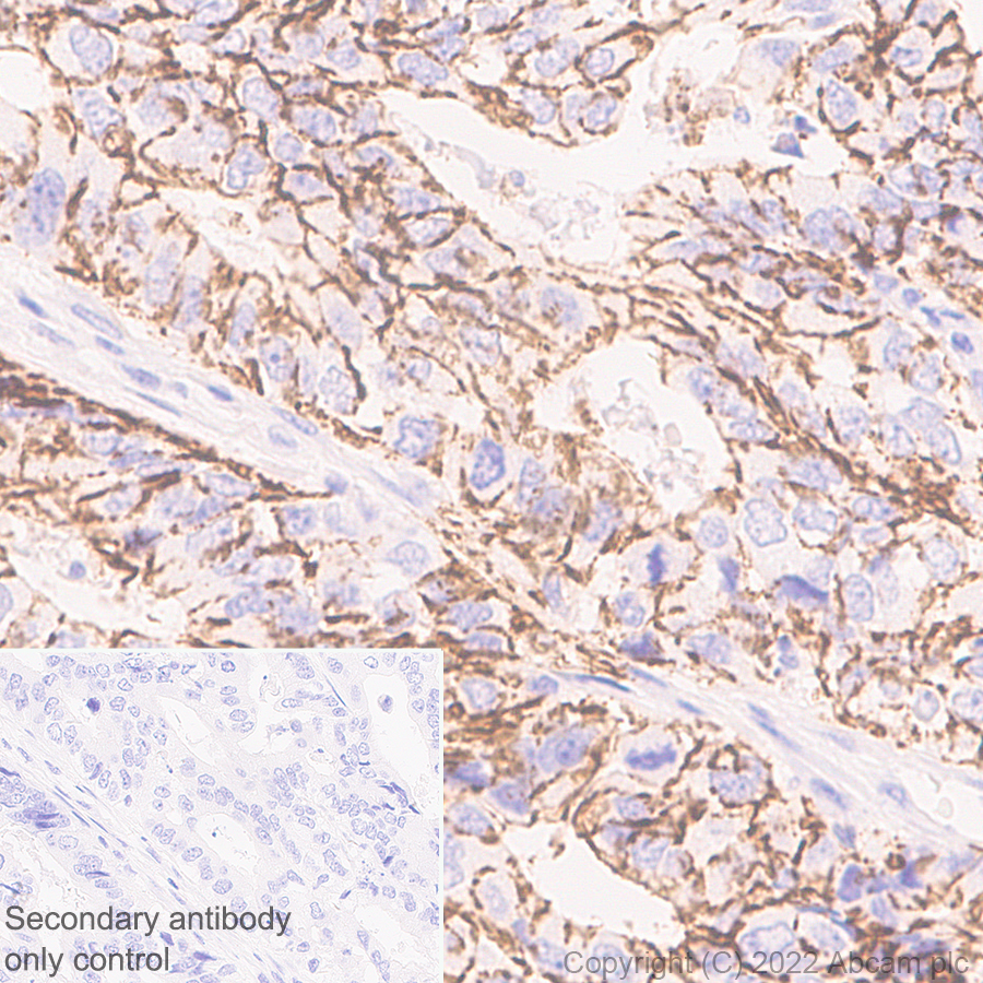 Immunohistochemistry (Formalin/PFA-fixed paraffin-embedded sections) - Anti-Claudin 1 antibody [EPR25359-48] (ab307692), expandable thumbnail