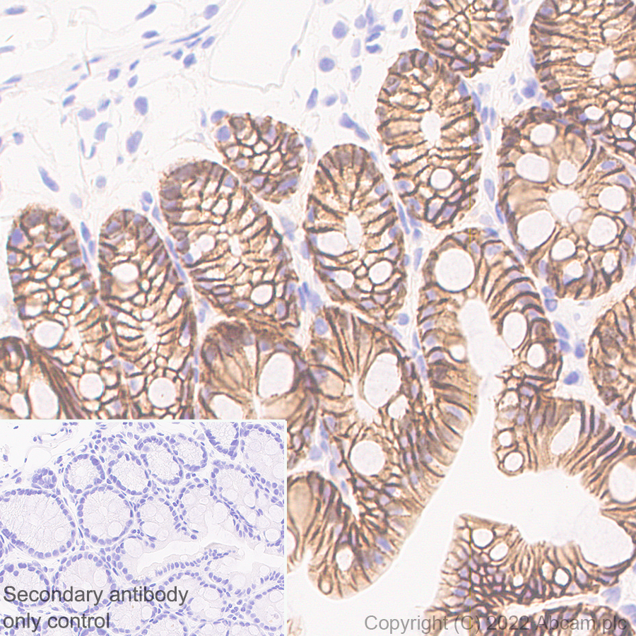 Immunohistochemistry (Formalin/PFA-fixed paraffin-embedded sections) - Anti-Claudin 1 antibody [EPR25359-48] (ab307692), expandable thumbnail