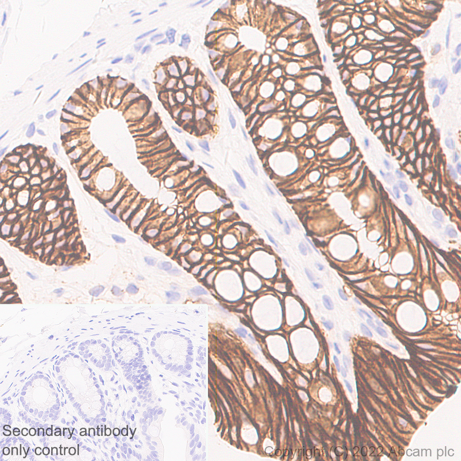 Immunohistochemistry (Formalin/PFA-fixed paraffin-embedded sections) - Anti-Claudin 1 antibody [EPR25359-48] (ab307692), expandable thumbnail