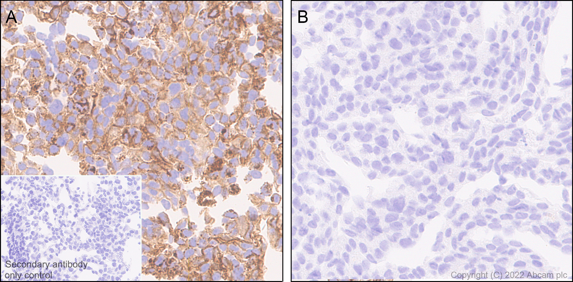 Immunohistochemistry (Formalin/PFA-fixed paraffin-embedded sections) - Anti-Claudin 1 antibody [EPR25359-48] (AB307692), expandable thumbnail