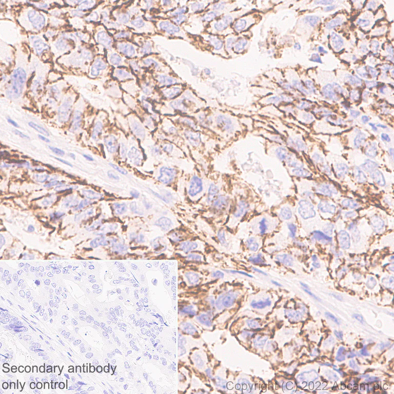 Immunohistochemistry (Formalin/PFA-fixed paraffin-embedded sections) - Anti-Claudin 1 antibody [EPR25359-48] - BSA and Azide free (AB307693)