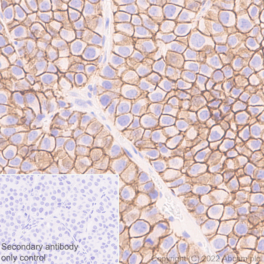 Immunohistochemistry (Formalin/PFA-fixed paraffin-embedded sections) - Anti-Claudin 1 antibody [EPR25359-48] - BSA and Azide free (ab307693), expandable thumbnail