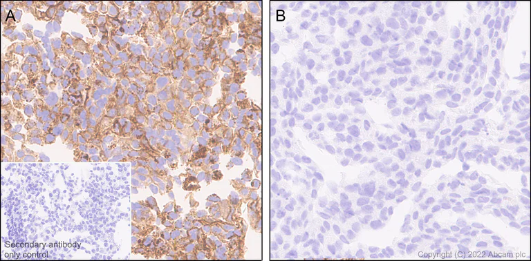 Immunohistochemistry (Formalin/PFA-fixed paraffin-embedded sections) - Anti-Claudin 1 antibody [EPR25359-48] - BSA and Azide free (AB307693)