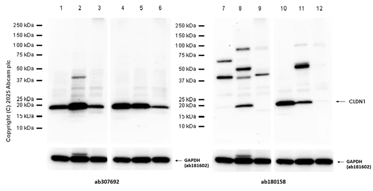 Western blot - Anti-Claudin 1 antibody [EPR9306] (AB180158)