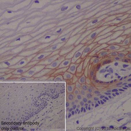 Immunohistochemistry (Formalin/PFA-fixed paraffin-embedded sections) - Anti-Claudin 1 antibody [EPRR18871] (ab211737), expandable thumbnail