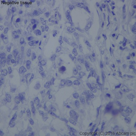 Immunohistochemistry (Formalin/PFA-fixed paraffin-embedded sections) - Anti-Claudin 1 antibody [EPRR18871] (ab211737), expandable thumbnail
