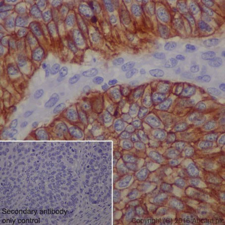 Immunohistochemistry (Formalin/PFA-fixed paraffin-embedded sections) - Anti-Claudin 1 antibody [EPRR18871] - BSA and Azide free (AB238949)