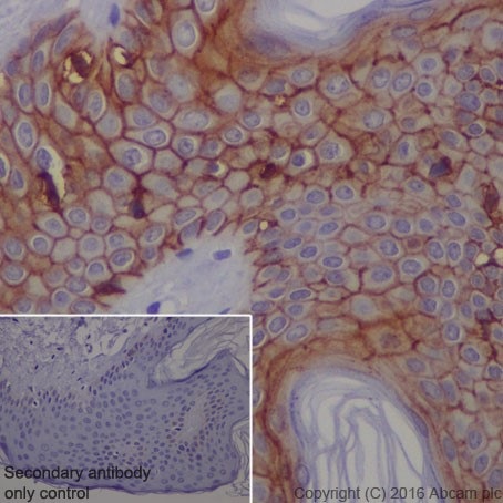 Immunohistochemistry (Formalin/PFA-fixed paraffin-embedded sections) - Anti-Claudin 1 antibody [EPRR18871] - BSA and Azide free (AB238949)