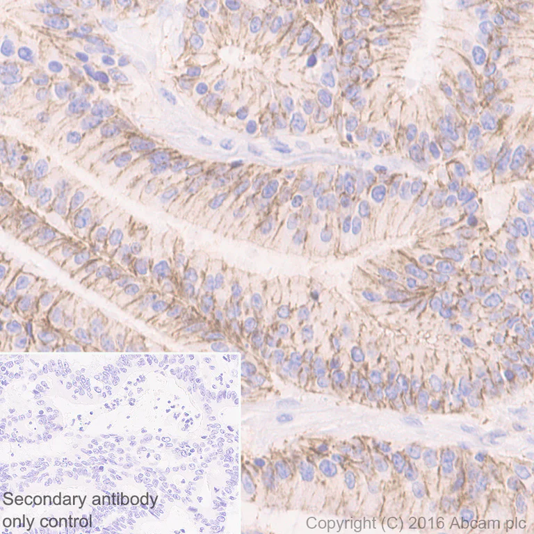 Immunohistochemistry (Formalin/PFA-fixed paraffin-embedded sections) - Anti-Claudin 1 antibody [EPRR18871] - BSA and Azide free (AB238949)
