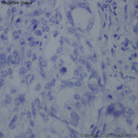 Immunohistochemistry (Formalin/PFA-fixed paraffin-embedded sections) - Anti-Claudin 1 antibody [EPRR18871] - BSA and Azide free (AB238949)