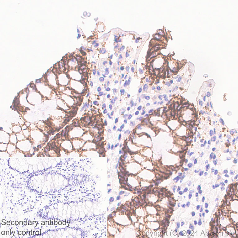 Immunohistochemistry (Formalin/PFA-fixed paraffin-embedded sections) - Anti-Claudin 1 antibody [RM1186] (AB317709)