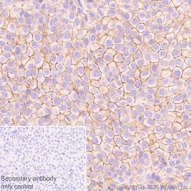 Immunohistochemistry (Formalin/PFA-fixed paraffin-embedded sections) - Anti-Claudin 1 antibody [RM1186] (AB317709)
