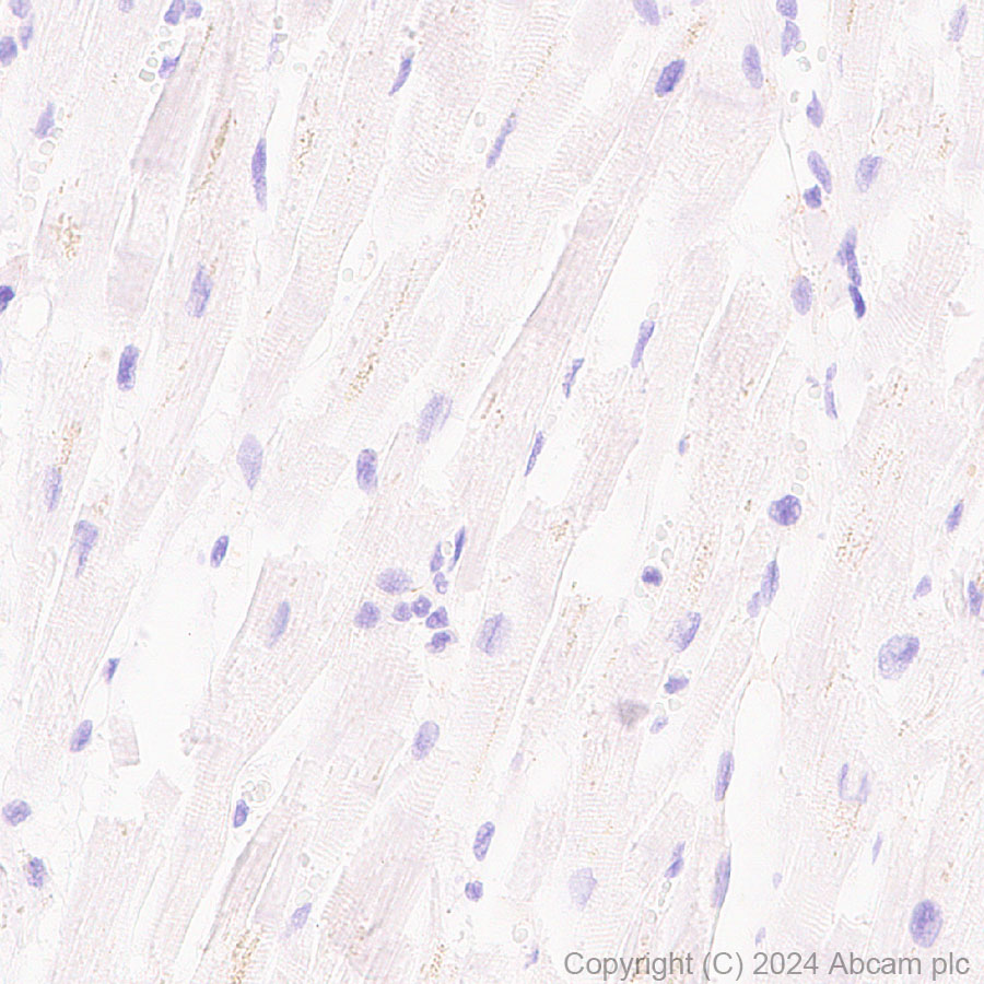 Immunohistochemistry (Formalin/PFA-fixed paraffin-embedded sections) - Anti-Claudin 1 antibody [RM1186] (AB317709)