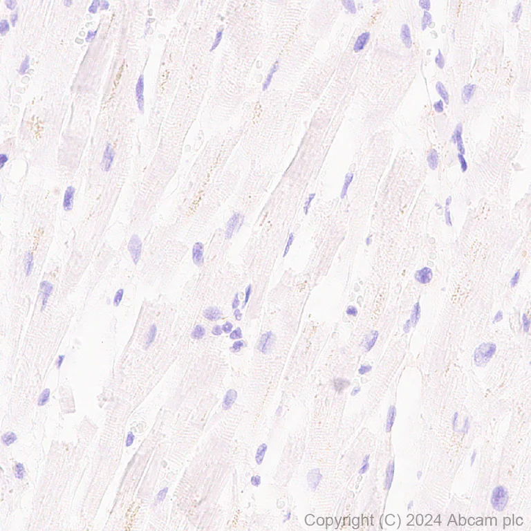 Immunohistochemistry (Formalin/PFA-fixed paraffin-embedded sections) - Anti-Claudin 1 antibody [RM1186] (AB317709)