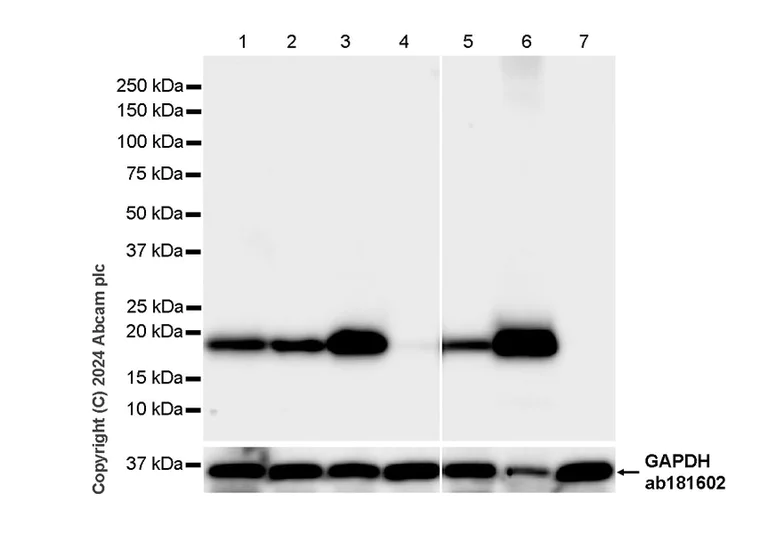 Western blot - Anti-Claudin 1 antibody [RM1186] (AB317709)