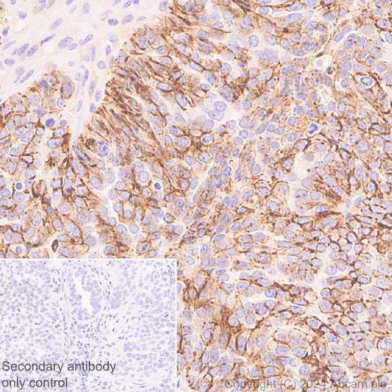 Immunohistochemistry (Formalin/PFA-fixed paraffin-embedded sections) - Anti-Claudin 1 antibody [RM1186] - BSA and Azide free (AB317710)