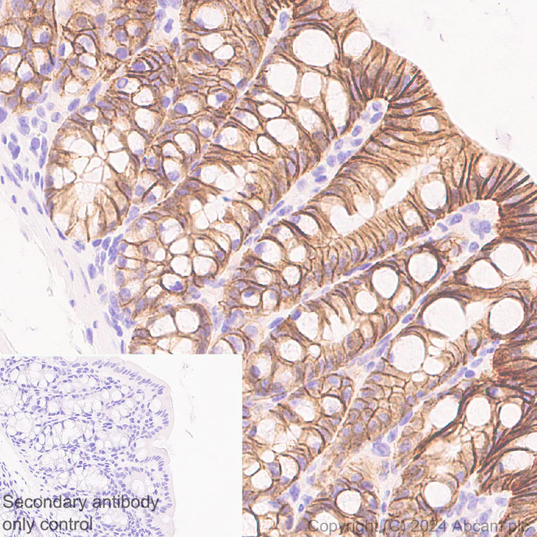 Immunohistochemistry (Formalin/PFA-fixed paraffin-embedded sections) - Anti-Claudin 1 antibody [RM1186] - BSA and Azide free (AB317710)