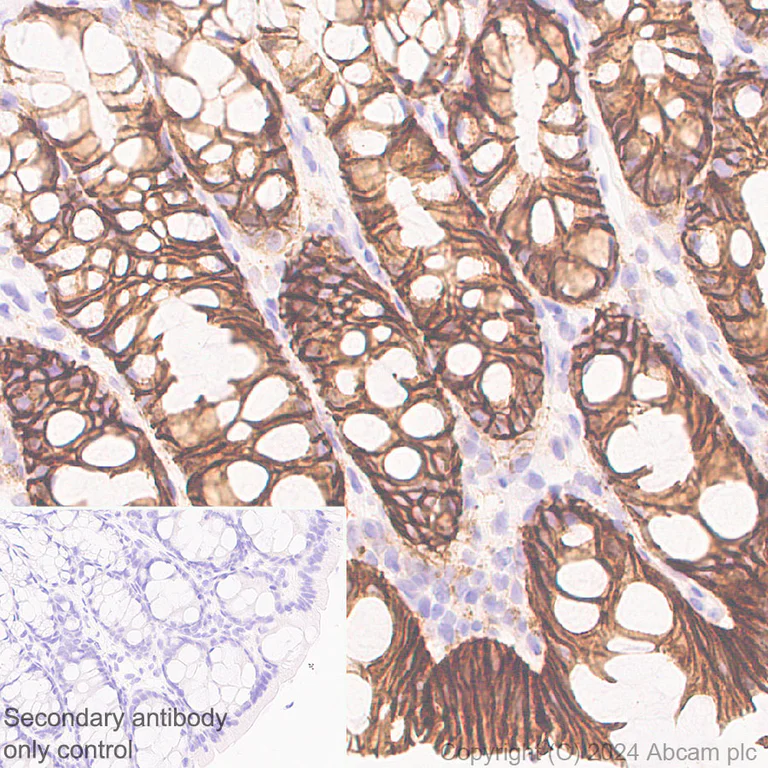 Immunohistochemistry (Formalin/PFA-fixed paraffin-embedded sections) - Anti-Claudin 1 antibody [RM1186] - BSA and Azide free (AB317710)