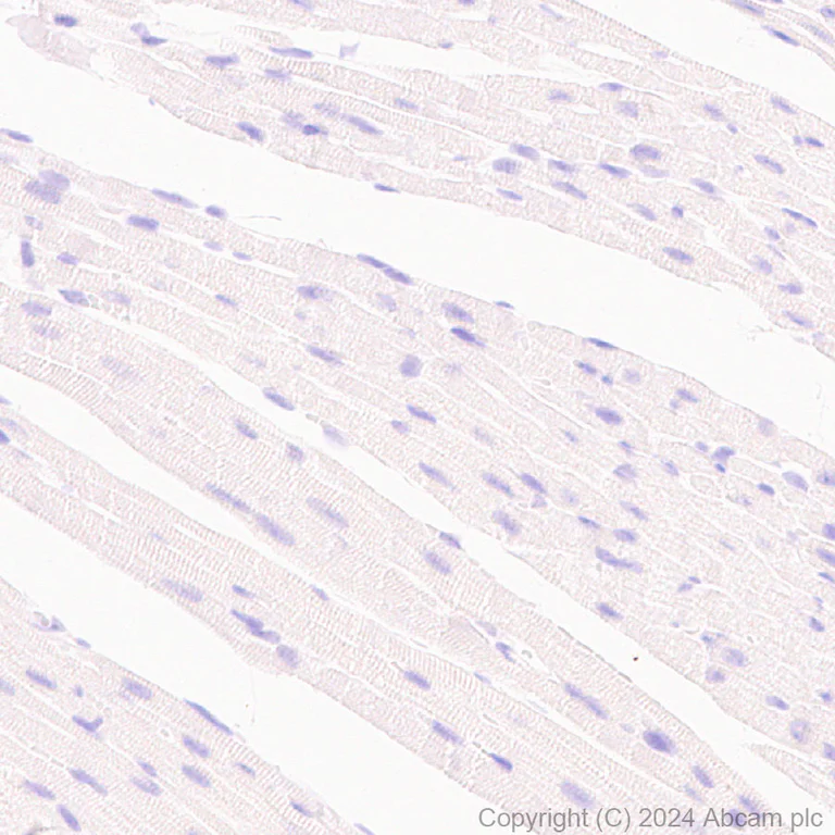 Immunohistochemistry (Formalin/PFA-fixed paraffin-embedded sections) - Anti-Claudin 1 antibody [RM1186] - BSA and Azide free (AB317710)