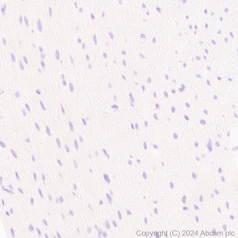 Immunohistochemistry (Formalin/PFA-fixed paraffin-embedded sections) - Anti-Claudin 1 antibody [RM1186] - BSA and Azide free (AB317710)