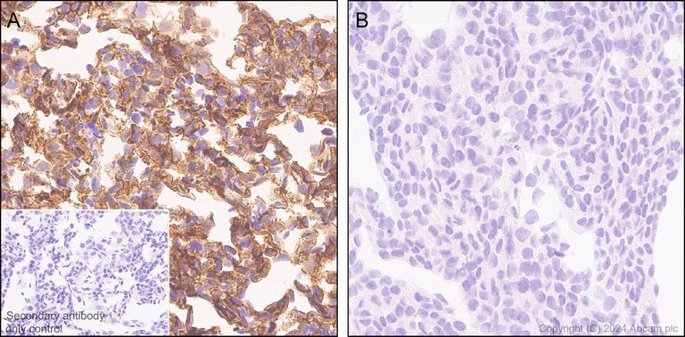 Immunohistochemistry (Formalin/PFA-fixed paraffin-embedded sections) - Anti-Claudin 1 antibody [RM1186] - BSA and Azide free (AB317710)