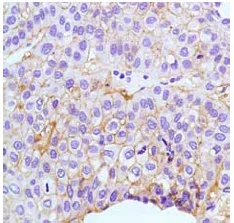 Immunohistochemistry (Formalin/PFA-fixed paraffin-embedded sections) - Anti-Claudin 1 antibody [SP128] (AB115783)