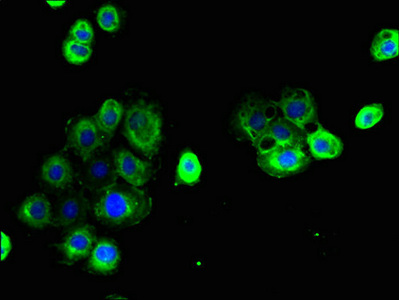 Immunocytochemistry/ Immunofluorescence - Anti-Claudin 15 antibody (AB238820)