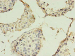 Immunohistochemistry (Formalin/PFA-fixed paraffin-embedded sections) - Anti-Claudin 15 antibody (AB238820)