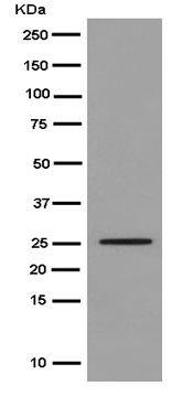 Western blot - Anti-Claudin 17 antibody [EPR15483] - BSA and Azide free (AB250897), expandable thumbnail