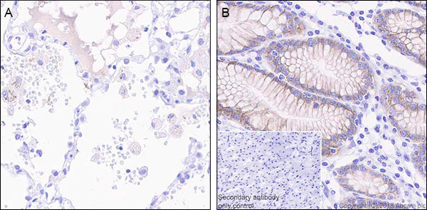 Immunohistochemistry (Formalin/PFA-fixed paraffin-embedded sections) - Anti-Claudin 18.2 antibody [EPR19202-244] - BSA and Azide free (AB242079)