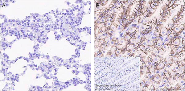 Immunohistochemistry (Formalin/PFA-fixed paraffin-embedded sections) - Anti-Claudin 18.2 antibody [EPR19202-244] - BSA and Azide free (AB242079)