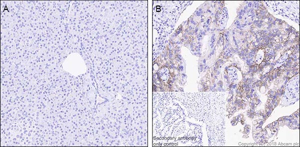 Immunohistochemistry (Formalin/PFA-fixed paraffin-embedded sections) - Anti-Claudin 18.2 antibody [EPR19202-244] - BSA and Azide free (AB242079)